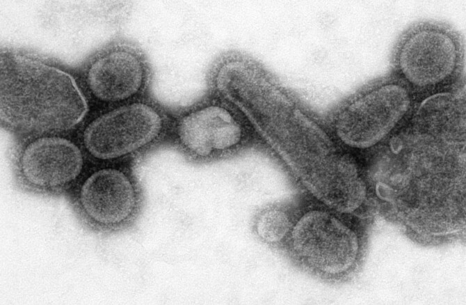 Hvordan kan virus gjøre oss så syke? Og hvorfor virker ikke antibiotika mot dem? (Bildet viser en versjon av viruset som forårsaket spanskesyken, gjenskapt av forskere ved Centers for Disease Control and Prevention.)