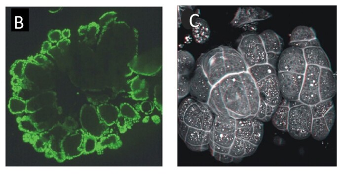 B: Runde celleklumper dyrket i prøverør består av melproduserende celler omgitt av aleuronceller (grønne). C: Mikroskopbilde av mini-endosperm dyrket i prøverør. B: Runde celleklumper dyrket i prøverør består av melproduserende celler omgitt av aleuronceller (grønne). C: Mikroskopbilde av mini-endosperm dyrket i prøverør.