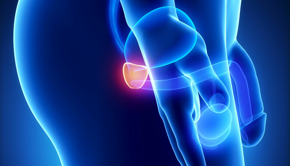 Prostatakjertelen ligger rundt urinrøret ved blæren hos menn. En ny kombinasjon av billedteknikker kan gjøre at vi ser tilbakefall ved prostatakreft tidligere.