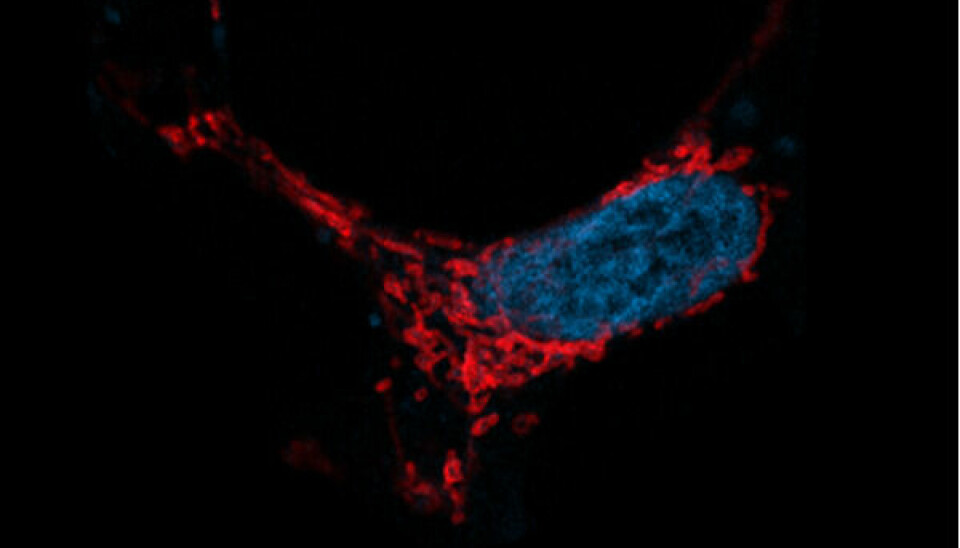 På bildet er en menneskecelle der cellekjernen er farget blå. Den røde fargen synligjør veldig interessante enheter som kan anses som batteriene til en celle. Batteriene vil selvfølgelig slutte å fungere etter en tid og må kastes, men hvordan håndterer cellene sitt avfall er avgjørende for at kroppen skal fungere.