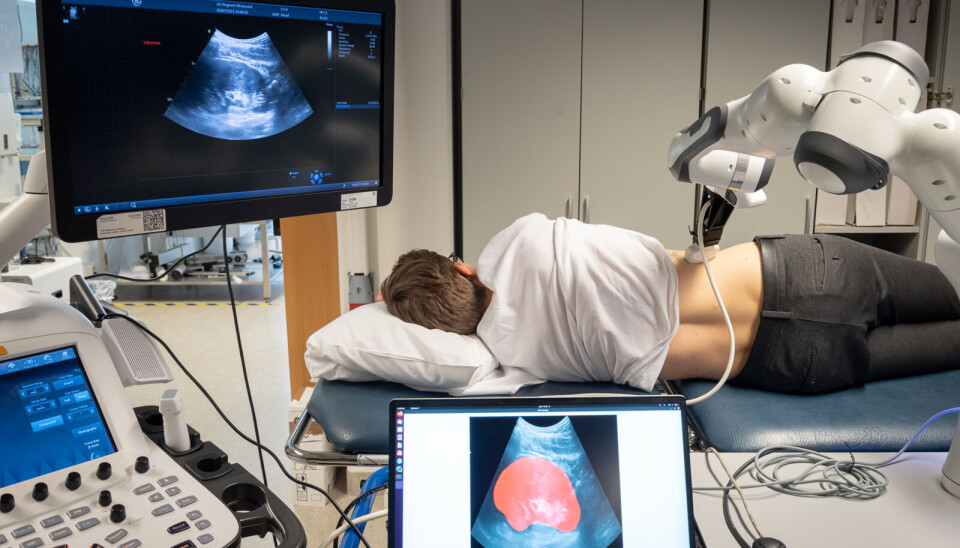 Eksperimentelt oppsett med robotarm, probe, ultralyd-skanner og bilde fra ultralyd image som følger organets utvikling over tid.